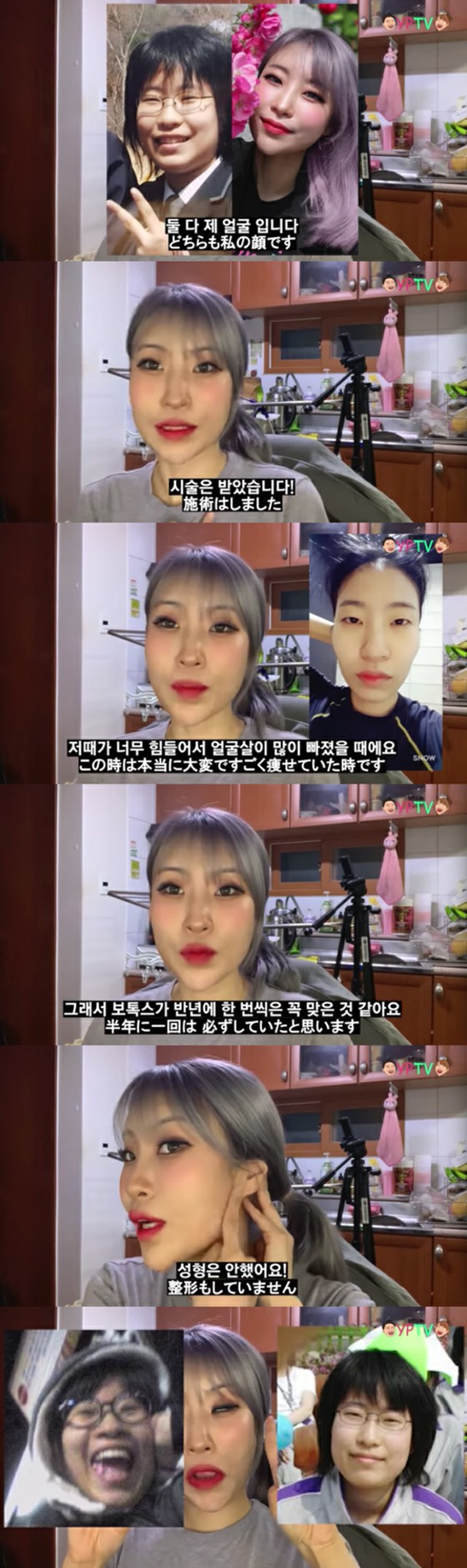 Lee Se Yeong, a comedian, mentions her own plastic surgery rumor... What secret were revealed comparing with photos from the past?