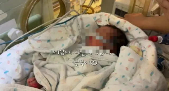 女優イ・シヨン、10月に出血で第2子を緊急出産した状況を公開… 1.9kgの未熟児で集中治療室へ
