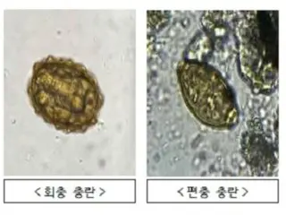 "Parasites" discovered in North Korea's "filthy balloon" = South Korea