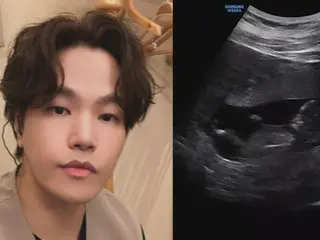 "Sung Si Kyung and others also congratulate him" Singer Na Yoon Kwon announces his wife's pregnancy 3 months after marriage... "See you in December"
