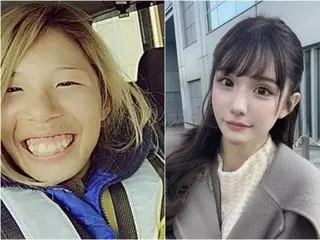 Influencer spends 24 million yen on 25 plastic surgeries "due to constant criticism of her appearance from her mother"