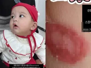 Lee Ji Hoon's wife Ayane releases shocking photos of her daughter... Skin disease is more serious than expected, "Please give me some advice"