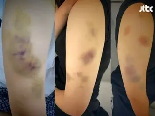 "I kept hitting her even after she fainted"... A taekwondo coach invaded a high school girl's accommodation without permission and assaulted her indiscriminately (South Korea)