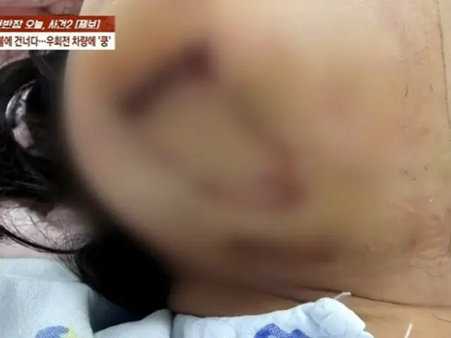 Shocking words from an 80-year-old unlicensed driver who hit and seriously injured an elementary school student in South Korea
