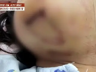 Shocking words from an 80-year-old unlicensed driver who hit and seriously injured an elementary school student in South Korea