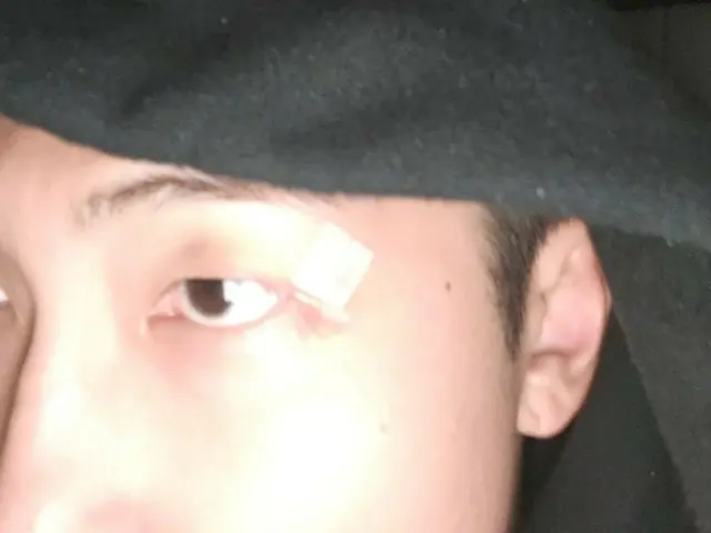 "BTS" RM, is the scar above his eye okay?