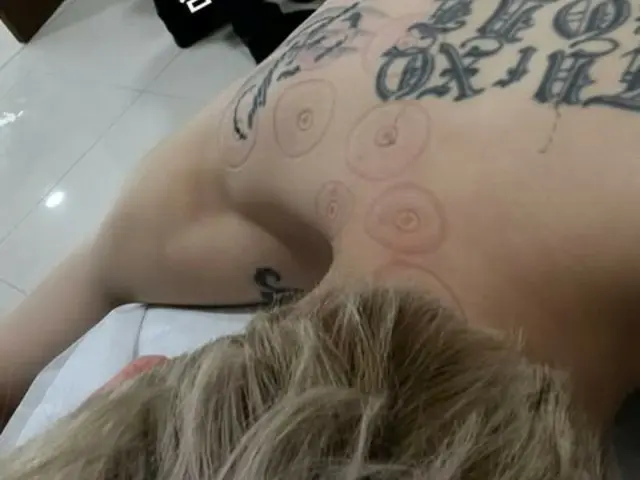 Jaejung undergoes treatment with traditional Chinese medicine... "Acupuncture is an art after all!"